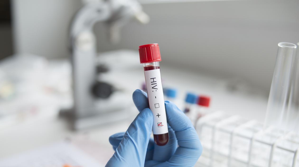 mujer curada de Sida